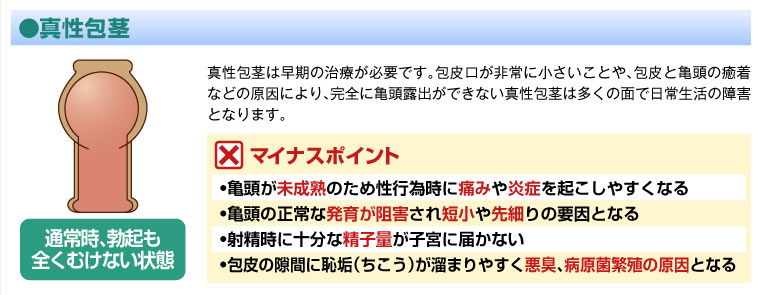 真性包茎